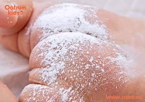 Bé bị hăm có nên bôi phấn rôm?