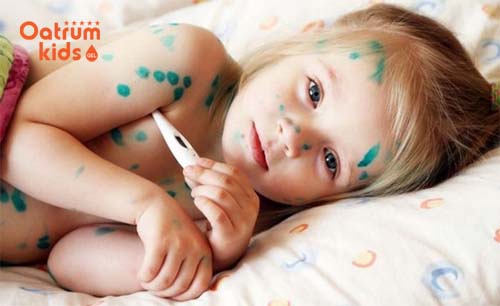 Bệnh tay chân miệng có nguy hiểm không