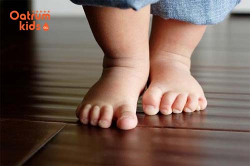 Cách chữa chân vòng kiềng cho bé hiệu quả nhất hiện nay