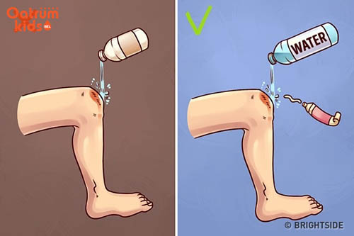 Có nhất thiết phải rửa vết thương trầy xước cho trẻ?
