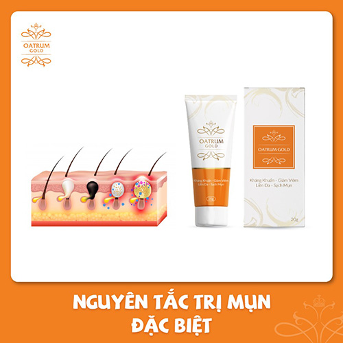 Công thức trị mụn đột phá từ hoạt chất Berberine