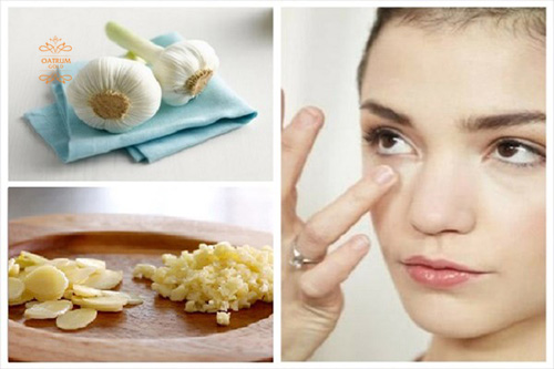 Đây là nguyên nhân khiến mặt tự nhiên nổi nhiều mụn bọc