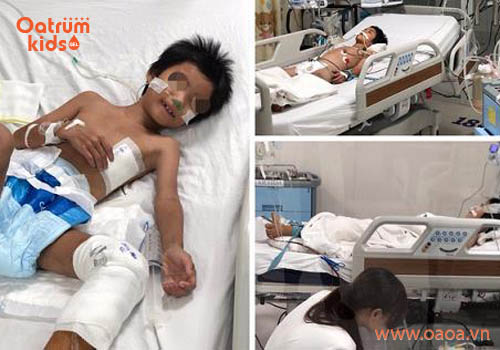 Nguy cơ chết người từ vết trầy xước ở đầu gối ở trẻ