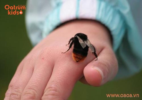Nguy hiểm tiềm ẩn khi trẻ bị mẩn ngứa do côn trùng cắn