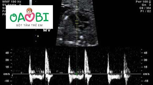 Những dấu hiệu thai nhi phát triển tốt trong 3 tháng đầu