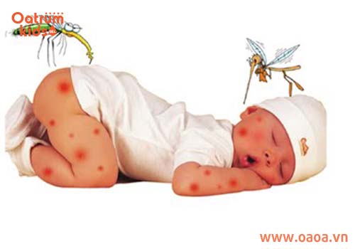Những sai lầm trong điều trị trẻ bị côn trùng cắn