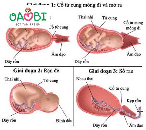 Quá trình sinh con diễn ra như thế nào?