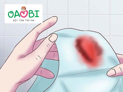 Ra máu báo nhưng không đau bụng xử lý như thế nào?