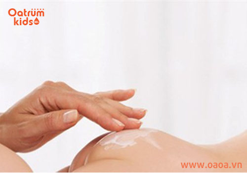 Sai lầm kinh điển trong điều trị hăm tã ở trẻ