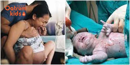 So sánh những ưu, nhược điểm giữa sinh thường và sinh mổ