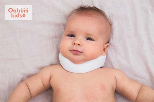 Tật vẹo cổ ở trẻ sơ sinh và những điều cha mẹ cần biết