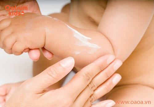 Thuốc bôi muỗi đốt cho bé tốt nhất hiện nay