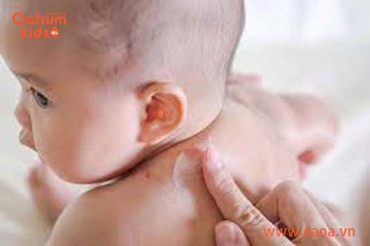 Tiết lộ 5 cách chữa mụn nhọt ở trẻ thịnh hành nhất hiện nay