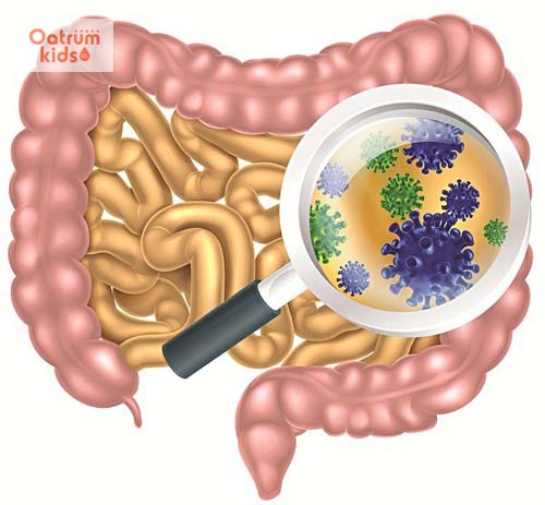 Trẻ bị nhiễm khuẩn đường ruột – Bệnh lý nguy hiểm cha mẹ chớ lên coi thường