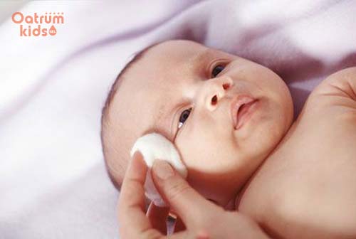 Trẻ sơ sinh bị chàm bôi thuốc gì để đảm bảo an toàn?