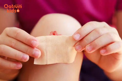 Vết trầy xước bị sưng: Mẹ cần làm gì để giúp con mau khỏi?